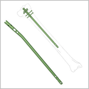 Expert Tibial Interlocking Nail